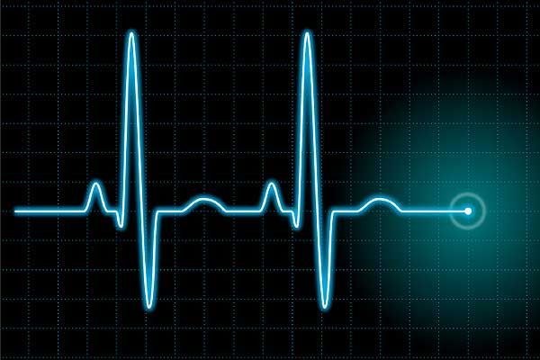 Wat zijn diffuse veranderingen in het myocardium? 